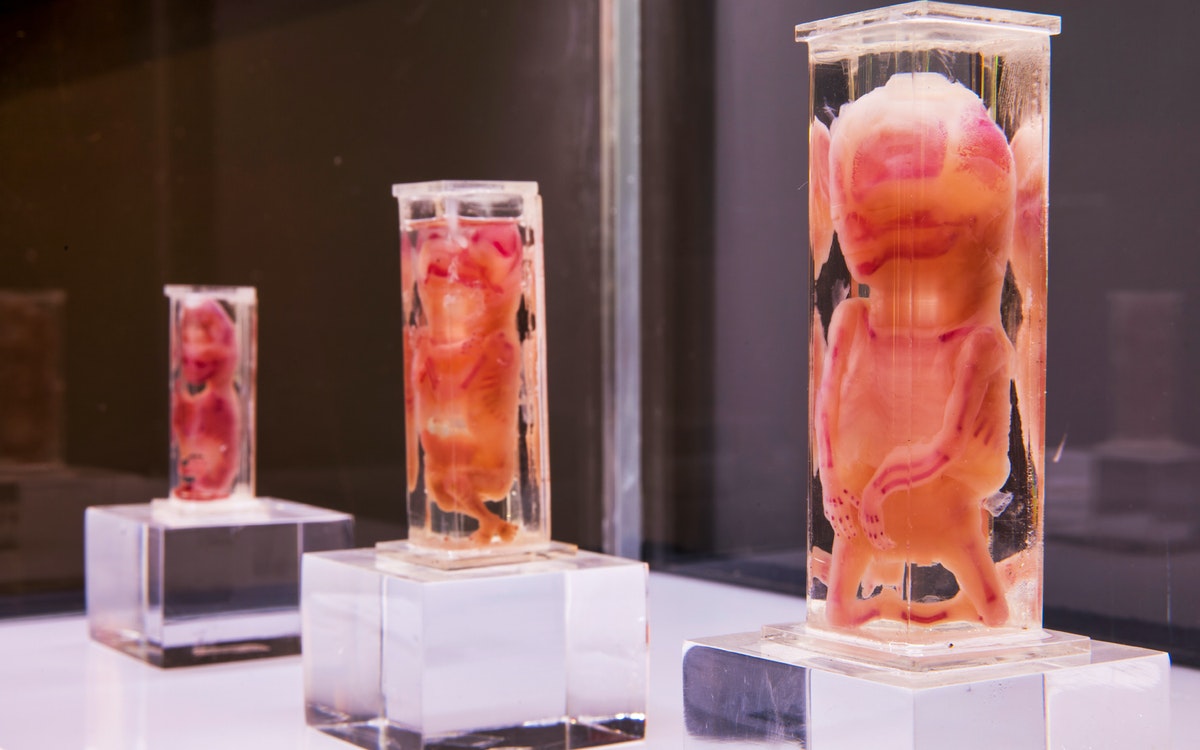 Wystawa Ludzkie ciała