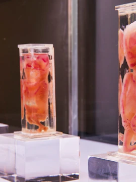 Preserved human embryos in glass cases at Barcelona Human Bodies Exhibition.