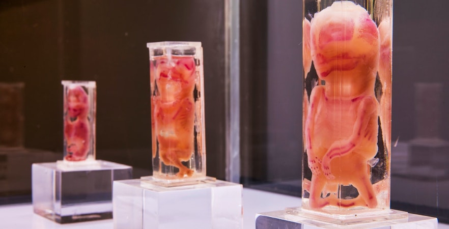 Human Bodies Ausstellung