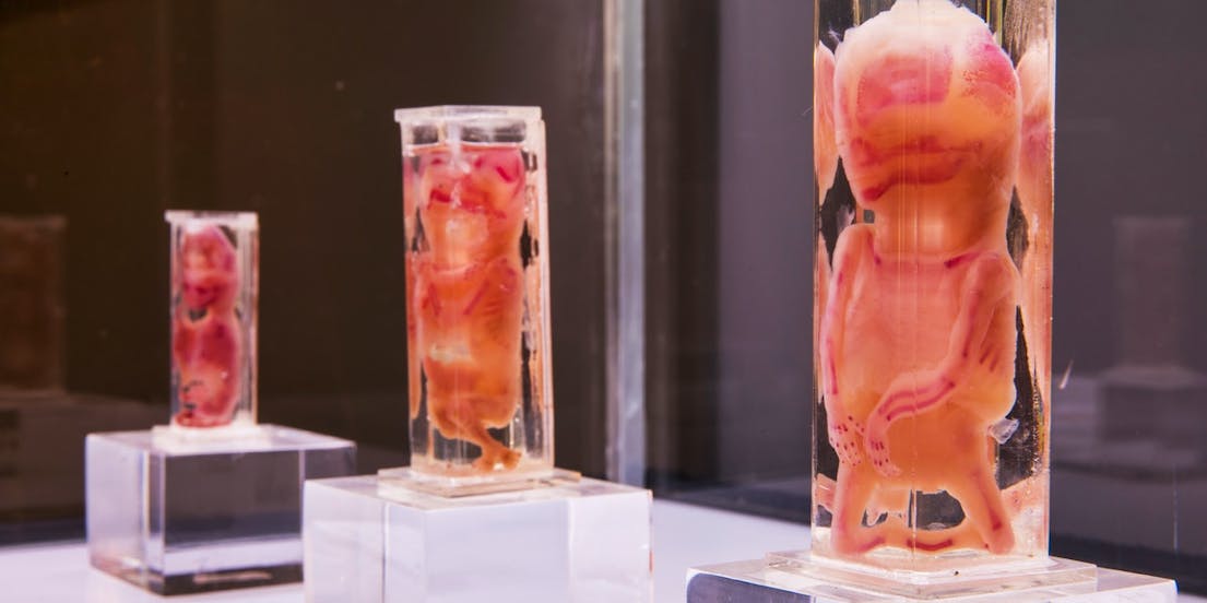 Human Bodies Ausstellung